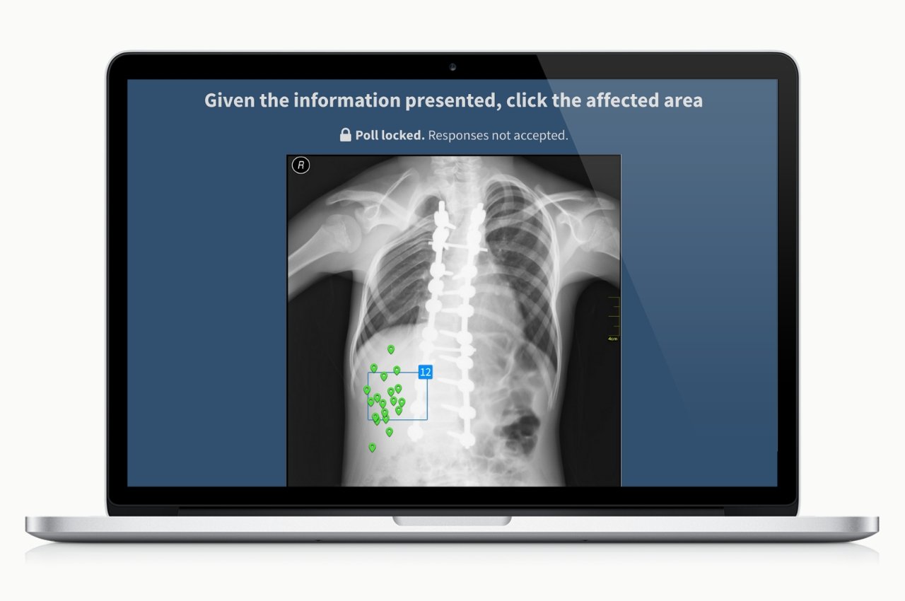 Poll: Click the affected area